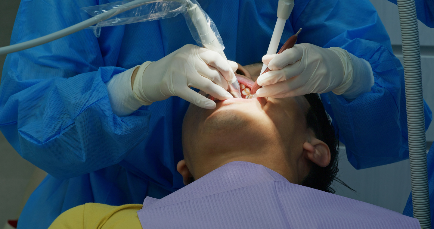 Asian Man Undergo Dental Scaling Treatment