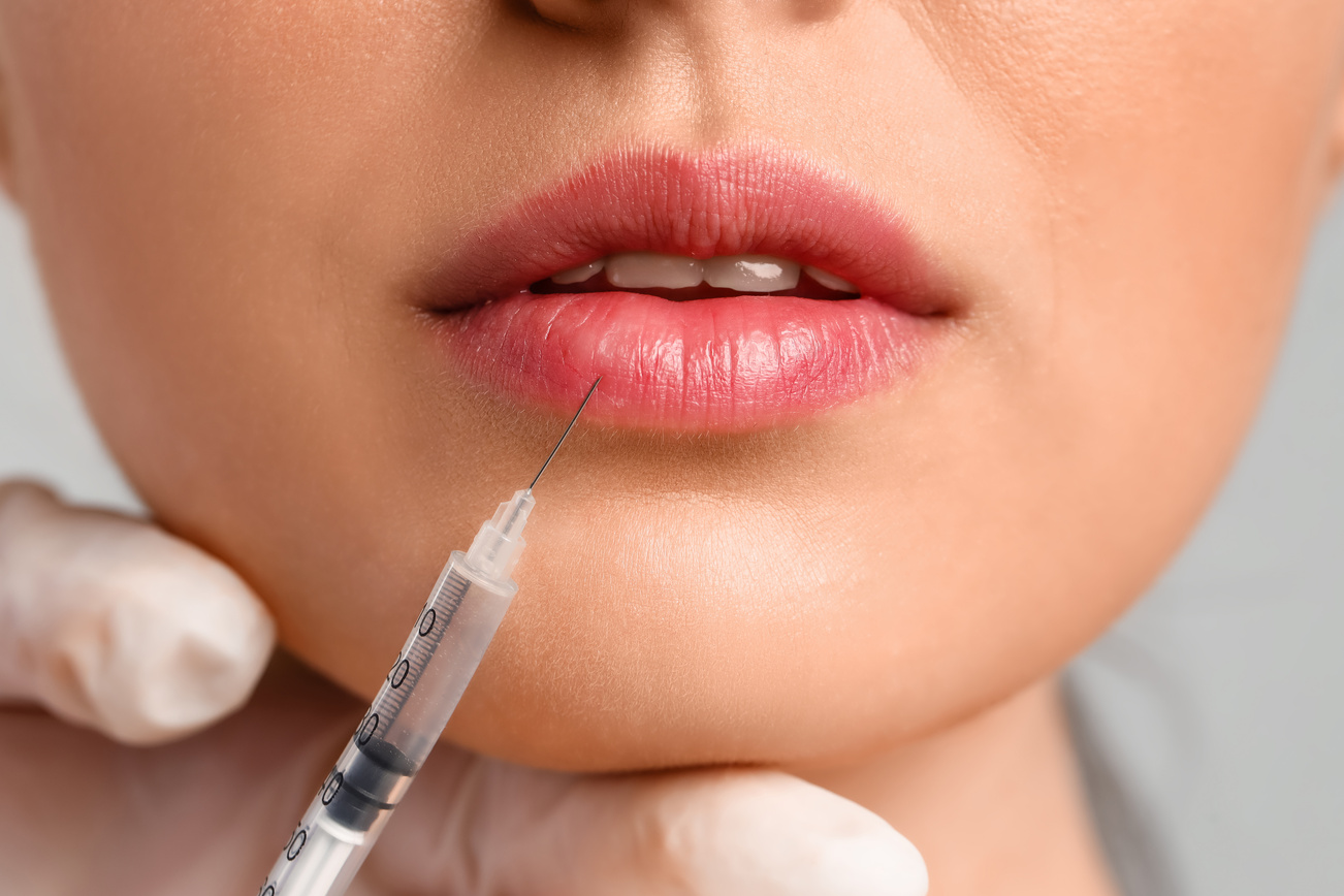 Young Woman Receiving Filler Injection in Lips, Closeup